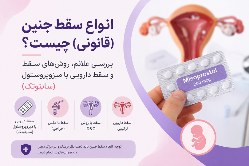 انواع سقط جنین چیست؟ بررسی علائم، روشهای سقط و سقط دارویی با میزوپروستول (سایتوتک)