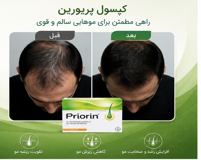 کپسول پریورین اینتنس ۱۲۰ عددی